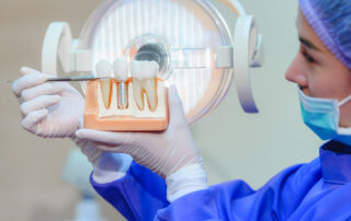 Dentist holding a model of dental implants in hand