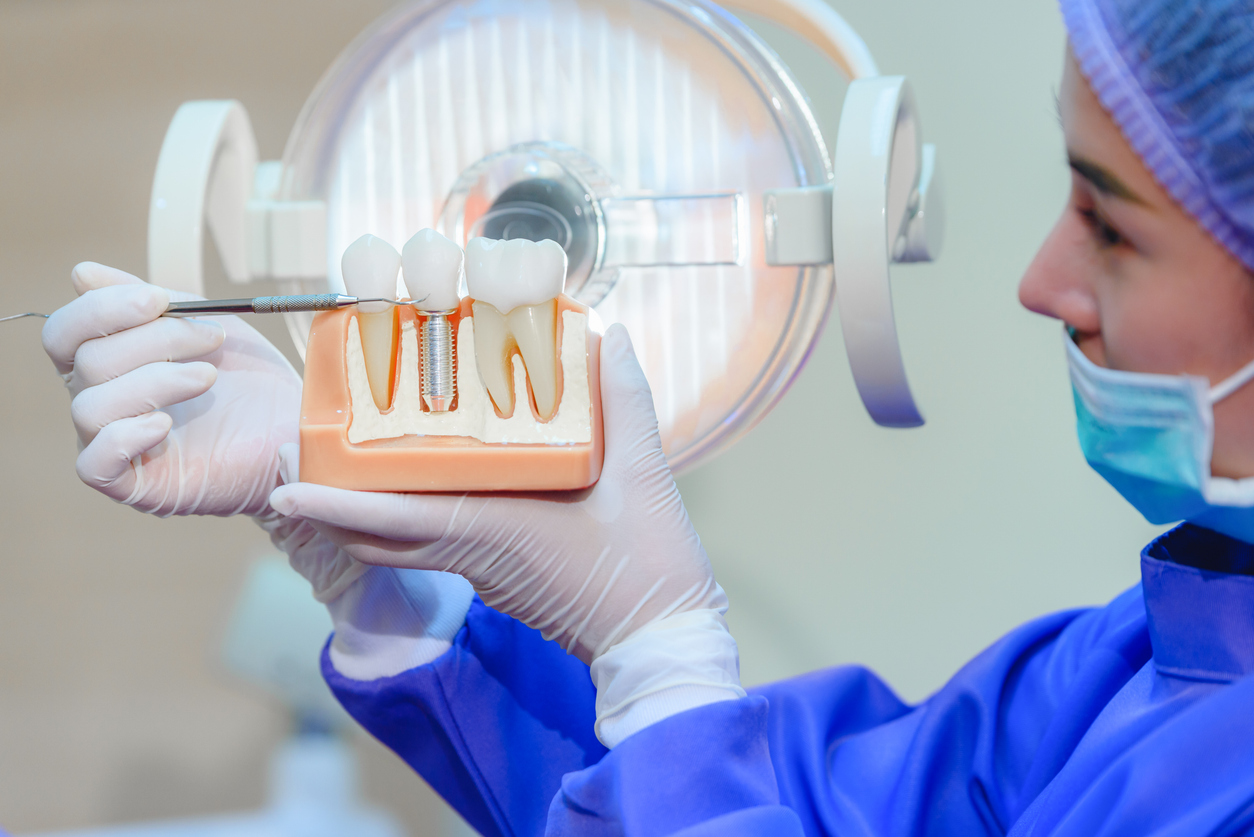 Dentist holding a model of dental implants in hand